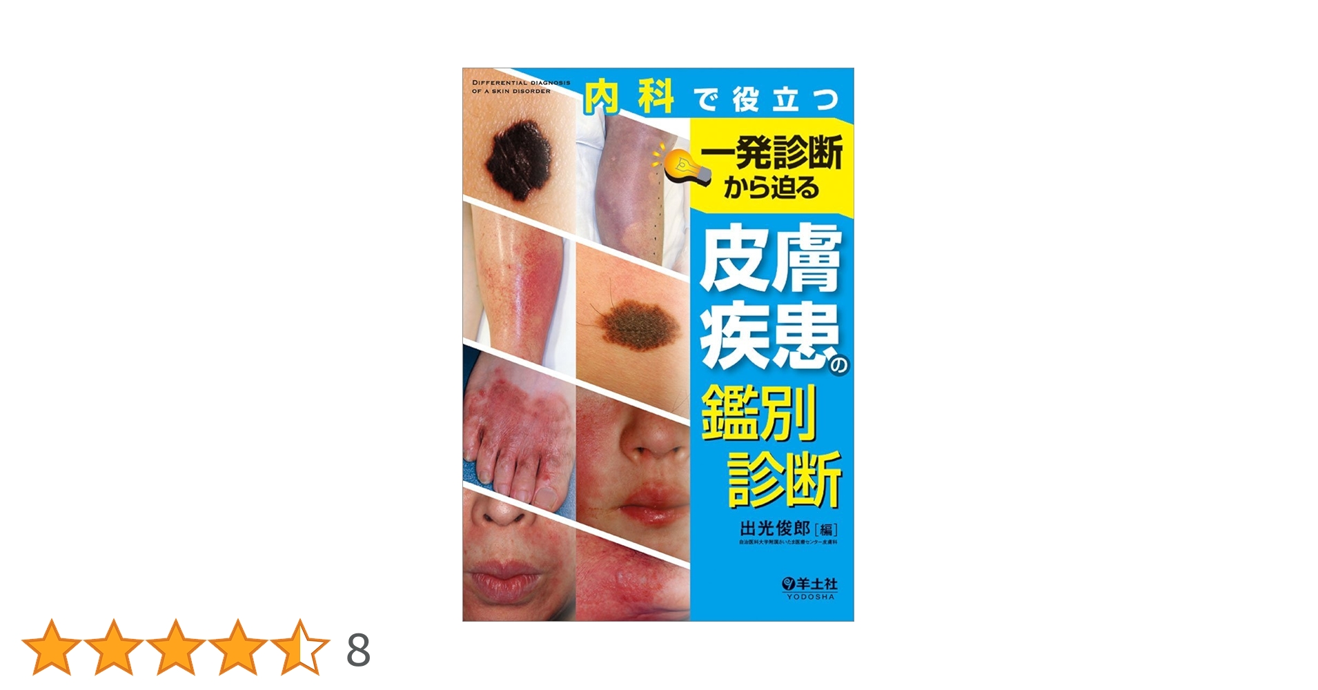 幼小児によくみられる皮膚疾患 鑑別と治療マニュアル  改訂３版/医薬ジャ-ナル社/石橋康正（大型本） 診療所で診る皮膚疾患 第3版 | 中村健一 |本 | 通販 | Amazon