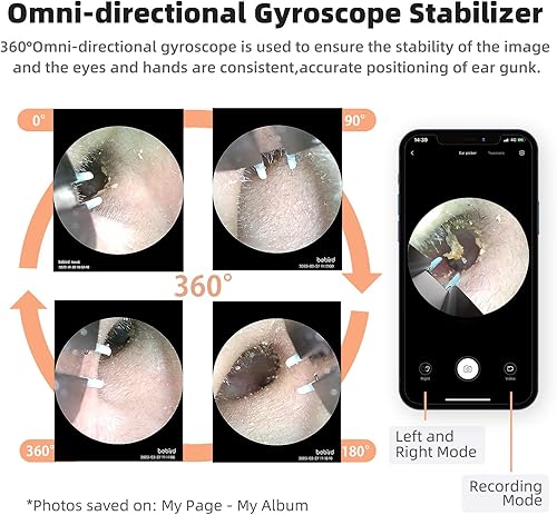 Miniatura 6 de Bebird Pro Note5 - Recogedor de orejas con pinzas para cámara, herramienta inalámbrica de eliminación de cera, otoscopio limpiador de cámara con luz