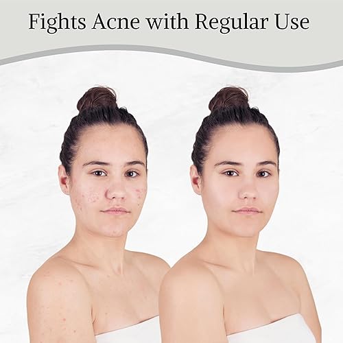 Miniatura 6 de Bare Essentials Living Mezcla de arcilla de bentonita y carbón activado en polvo para máscara facial de arcilla, faciales, máscara de barro para el