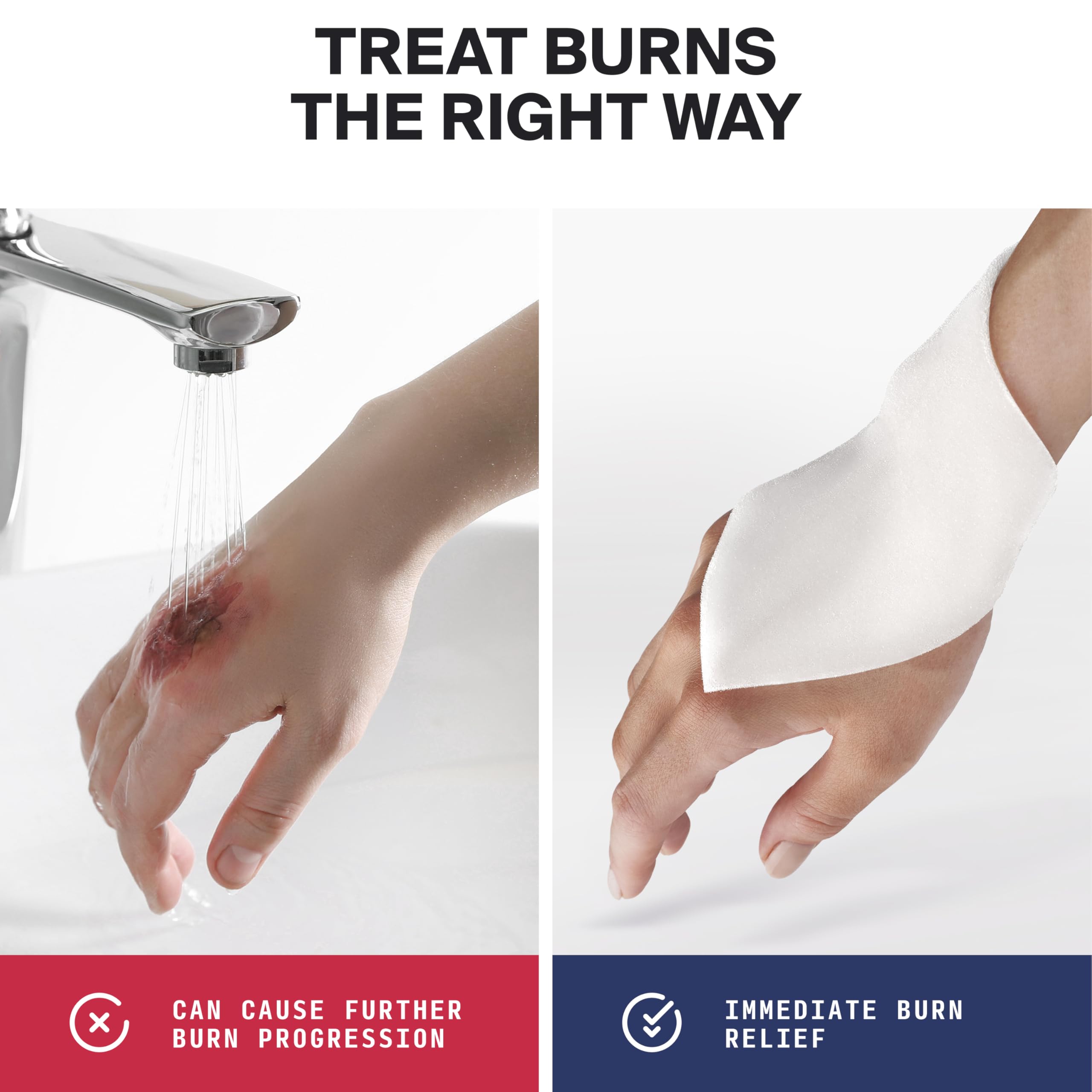 SurviveX Hydrogel Burn Dressings - First Aid Burn Care Pads, 5-Pack — Amazon image 8