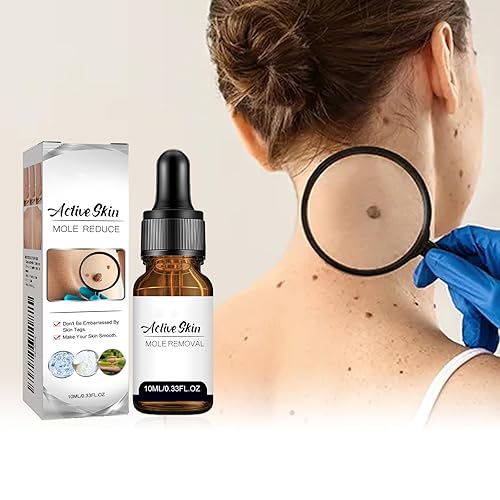 Miniatura 2 de Removedor de lunares de piel de ácido salicílico para cara y cuerpo, suero de eliminación de verrugas con cuentagotas de precisión, eliminación de