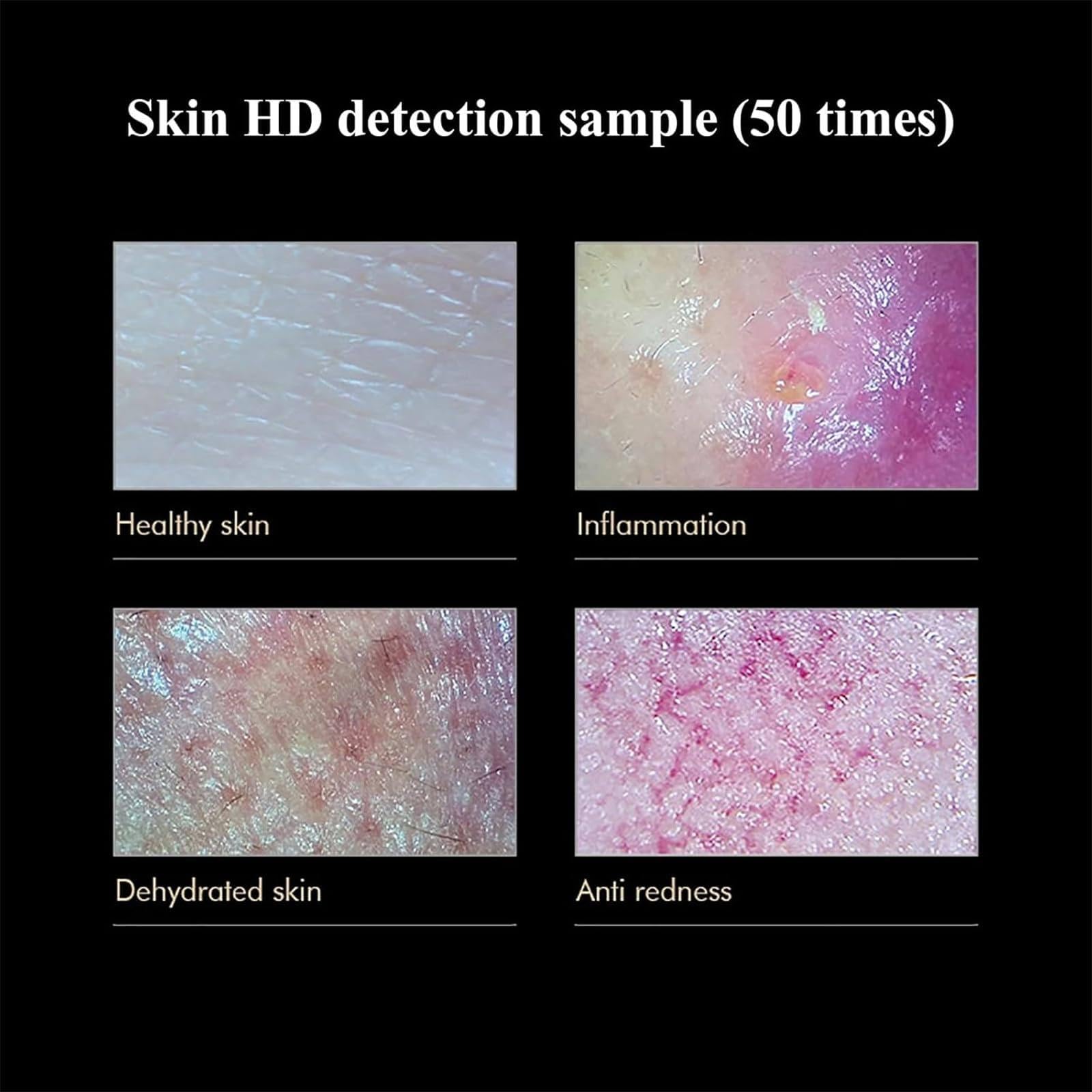 Detector De Cuero Cabelludo Inteligente Con Pantalla 14,1 Pulgadas Con Sondas Duales De 200x Y 50x, Detector De Piel Facial De Alta Definición (4 Espectros), Análisis De 360°