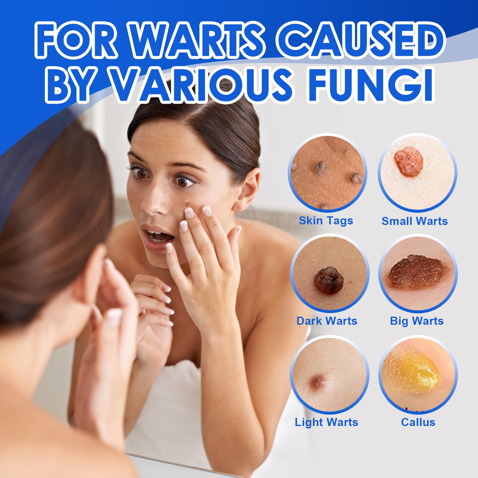 Líquido exfoliante para el cuidado de la piel 30 ml, para verrugas, mejora la textura de piel áspera y protuberancias cutáneas, uso en cara, cuello, manos y pies