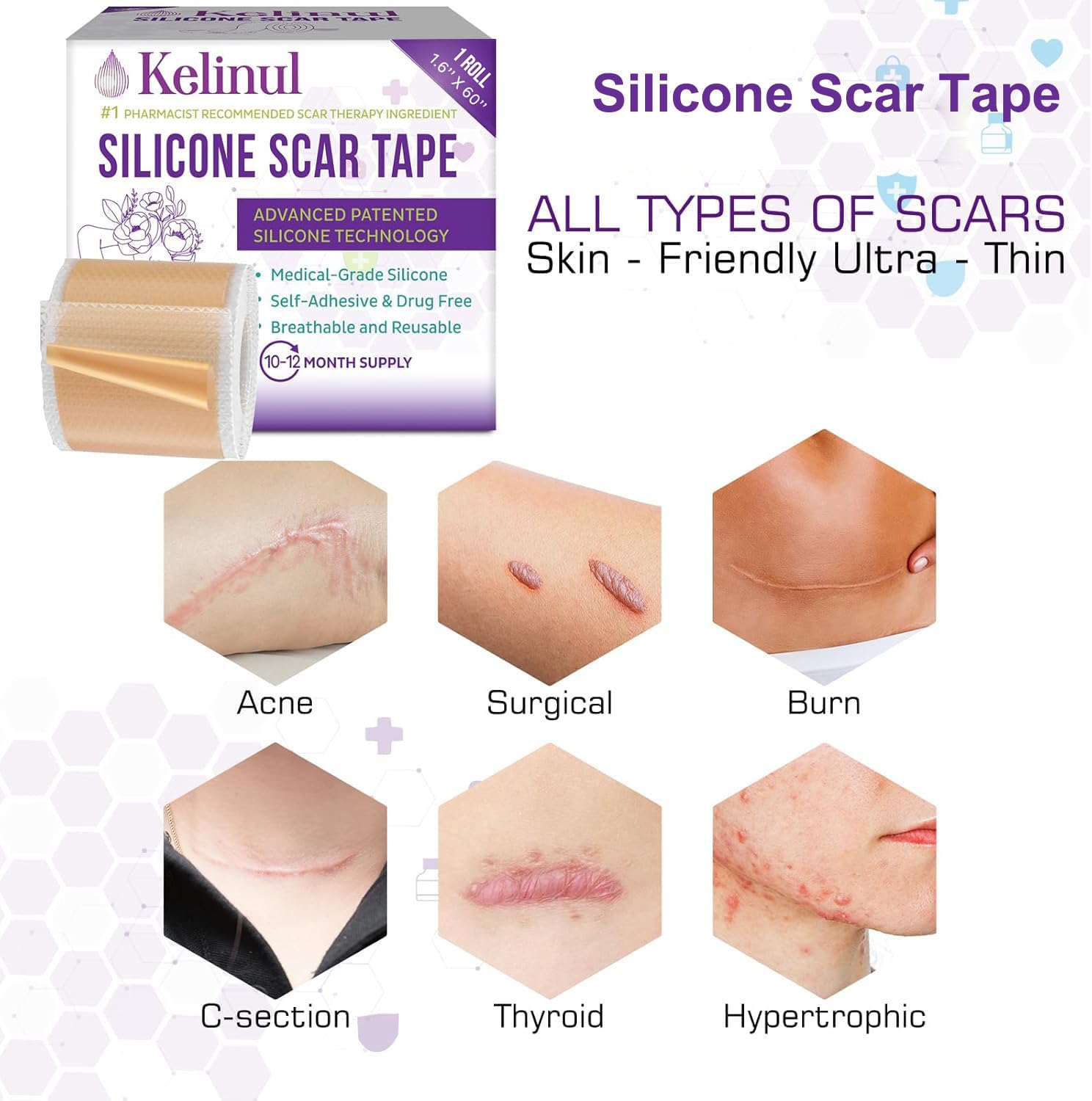 Silicone Scar Sheets(1.6'' x 60''Roll-1.5M) - Soft Silicone Gel Scar Tape Painless Silicone Tape Roll - Reusable, Medical Grade Silicone Scar Removal Strips for C-Sectio