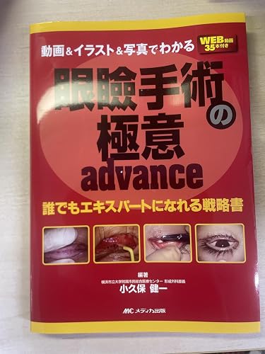 動画＆イラスト＆写真でわかる眼瞼手術の極意 advance：誰でも