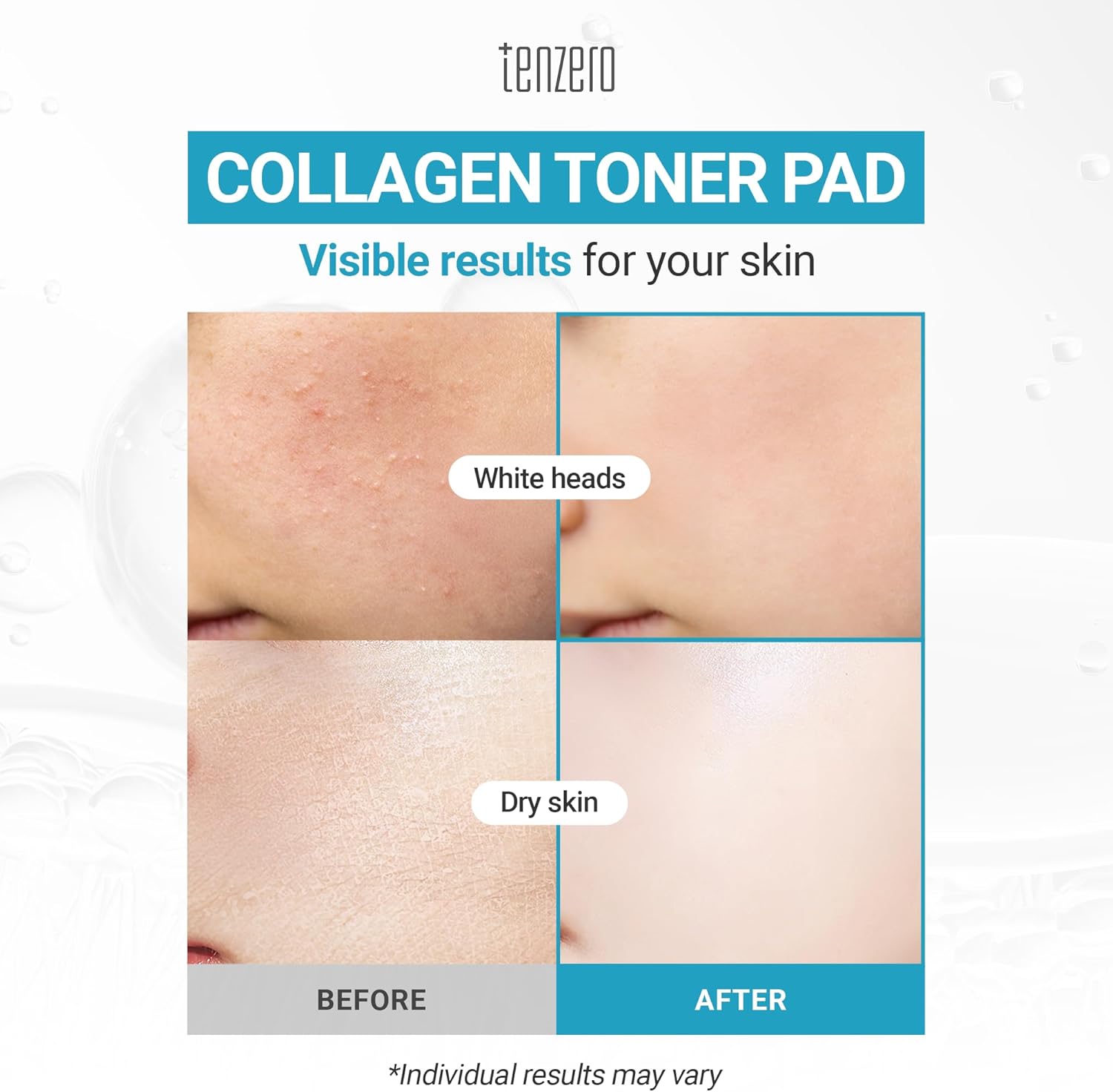 TENZERO Moisture Collagen Toner Pad (70 Count, 160g), 100% Natural Cotton, Hydrating Moisturizing Glowing Face Toner Pads, Gentle Exfoliate & Improve Elasticity, Korean Facial Toner, Dry & Dull Skin - Image 2