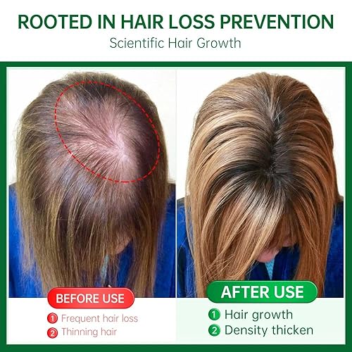 Miniatura 6 de BlueQueen Adivasi - Aceite natural puro para el cabello, hecho por Pure Adivasi, aceite indio para el cabello para hombres y mujeres, aceite bio