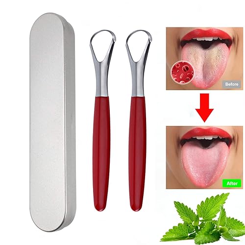 Miniatura 2 de MEOOAWQI Raspador de lengua con mango rojo (paquete de 2), cura el mal aliento (no médico), limpiadores de lengua de acero inoxidable, raspadores de