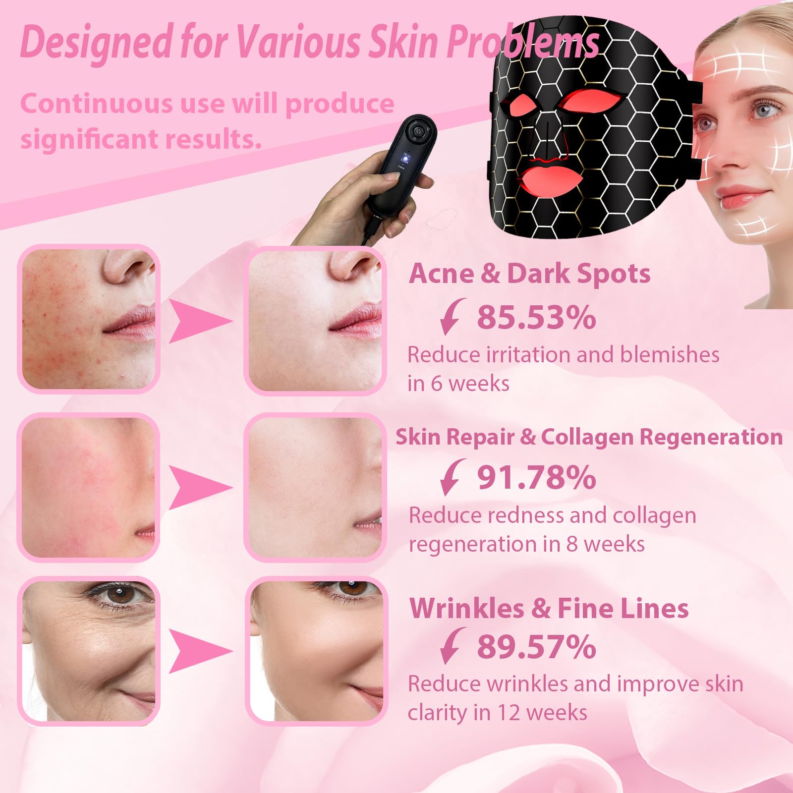 Máscara LED Facial, Quellsotty Máscara Facial LED con Terapia de Luz Roja para La Cara y La Piel, 7 Colores Mascarilla LED para Rejuvenecimiento, Anti-envejecimiento