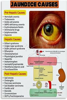 Causes Of Jaundice Poster Medical Knowledge Poster (5) Canvas for Bedroom Living Room Decor 12x18inch(30x45cm) Unframe-style