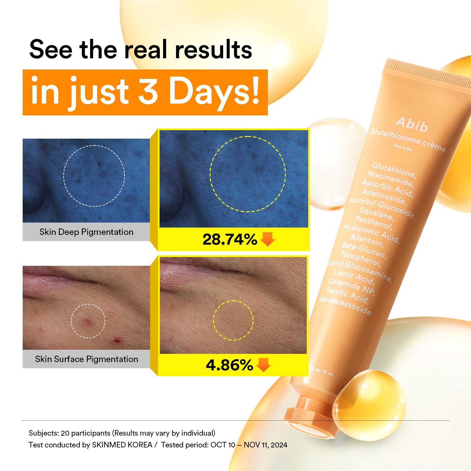 glutathione tube cream Amazon.com: Abib Glutathiosome Cream Vita Tube, Moisturizer for Dull,  Uneven Skin 2.53 fl oz : Beauty & Personal Care