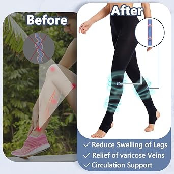 +MD 140D Light Compression Pantyhose for Women, 15-20mmHg Graduated Compression Tights, Footless Leggings for Leg Support
