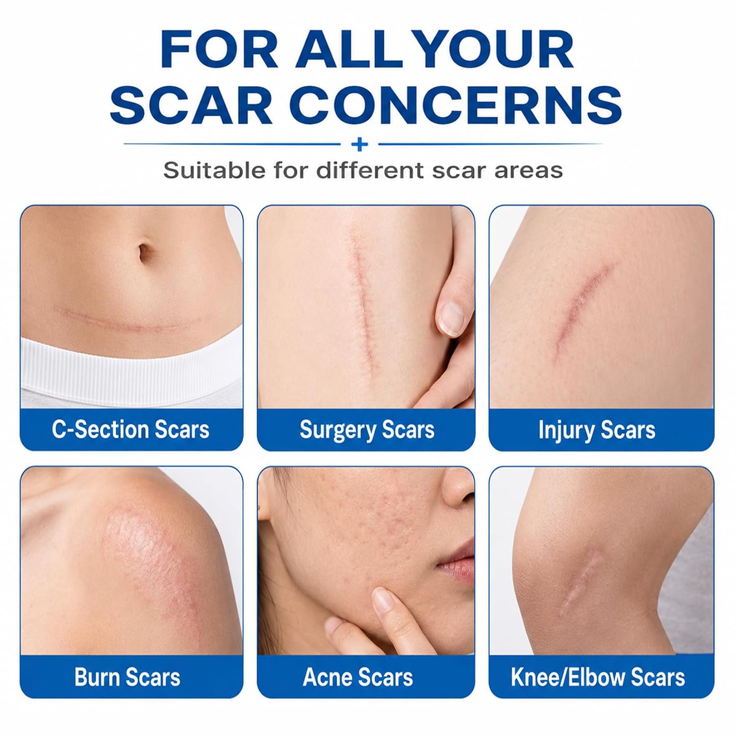 Silicone Scar Sheets - Waterproof Silicone Scar Tape, Reusable C Section Scar Silicone Strips for Surgical Scars, C Section, Keloid Bump, Burns Scar Recovery, 1.57 x 2.95 Inches, 10 Count