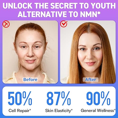 Miniatura 7 de nmnh, 120 unidades