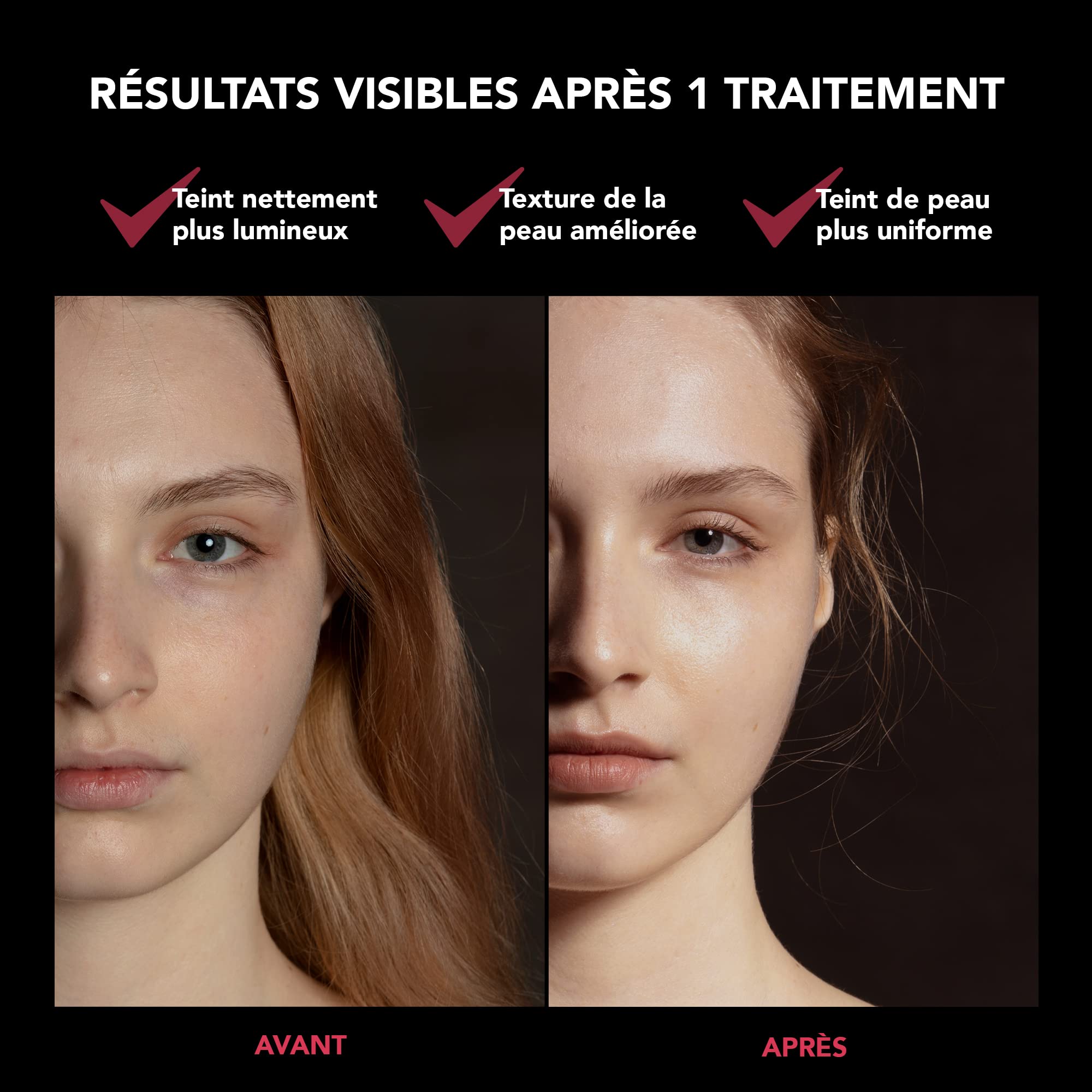 FAQ 201 Masque luminothérapie visage LED RVB | Anti-âge et rides | Soin visage localisé | Traitement de l'acné | Masques de beauté LED sans fil | 600 Points lumineux | Appareil de soin visage portable