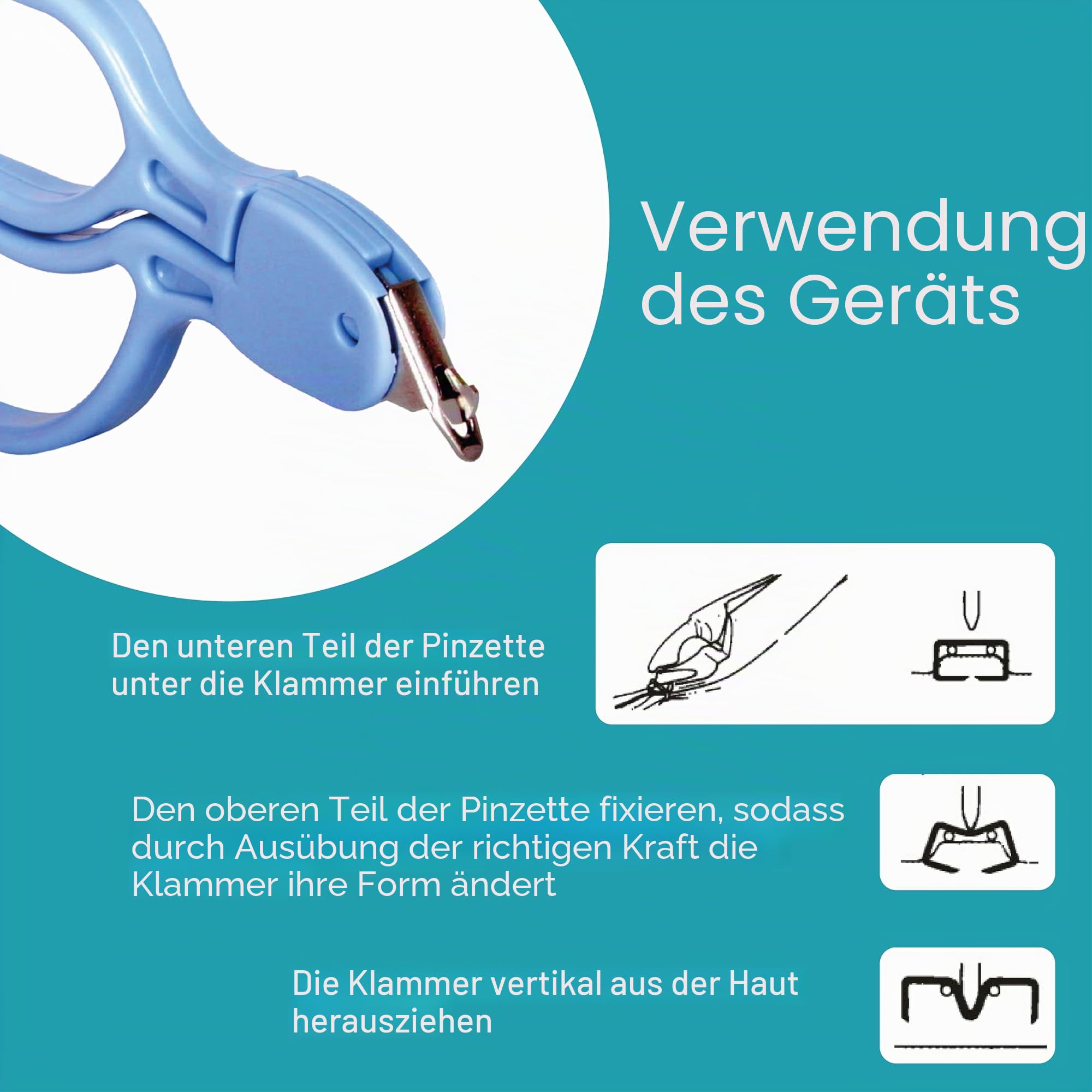 Gima - EINMAL SKIN Enthefter