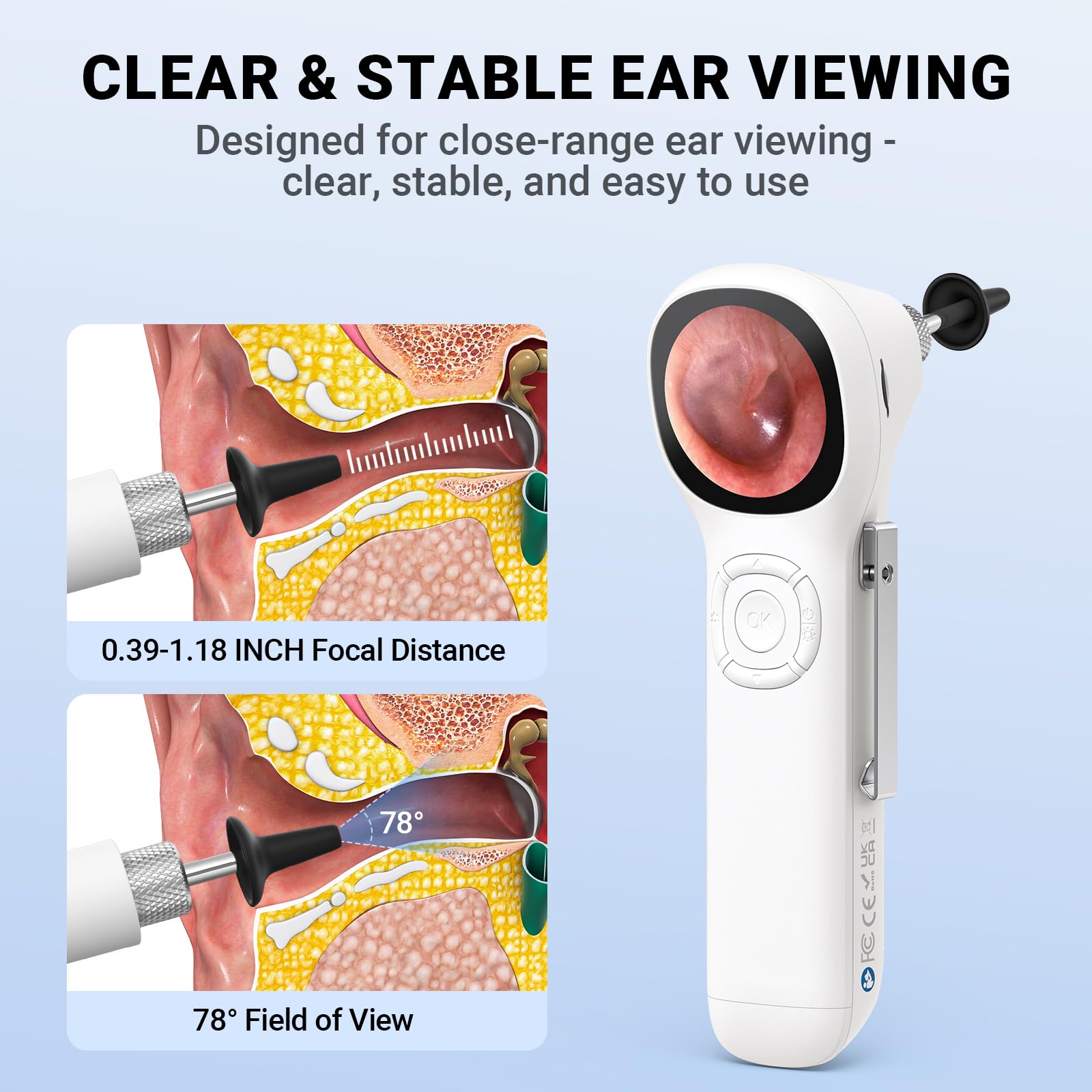 ScopeAround Otoscopio Digital con Pantalla IPS, otoscopio de Video Inteligente HD de 720p con luz, otoscopio para el oído con cámara de eliminación de Cera de oído, comprobador de oídos, Encendido y