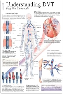 Vascular Knowledge Metal Signs Understanding Dvt Deep Vein Thrombosis Tin Posters Vascular Surgeon Office Science Guide Plaque Hospital Home Clinic Learning Wall Decor 8x12 Inch