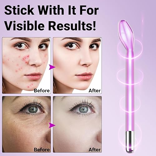 Miniatura 3 de Accesorio de vidrio de repuesto para dispositivo facial de alta frecuencia tubo de tubo