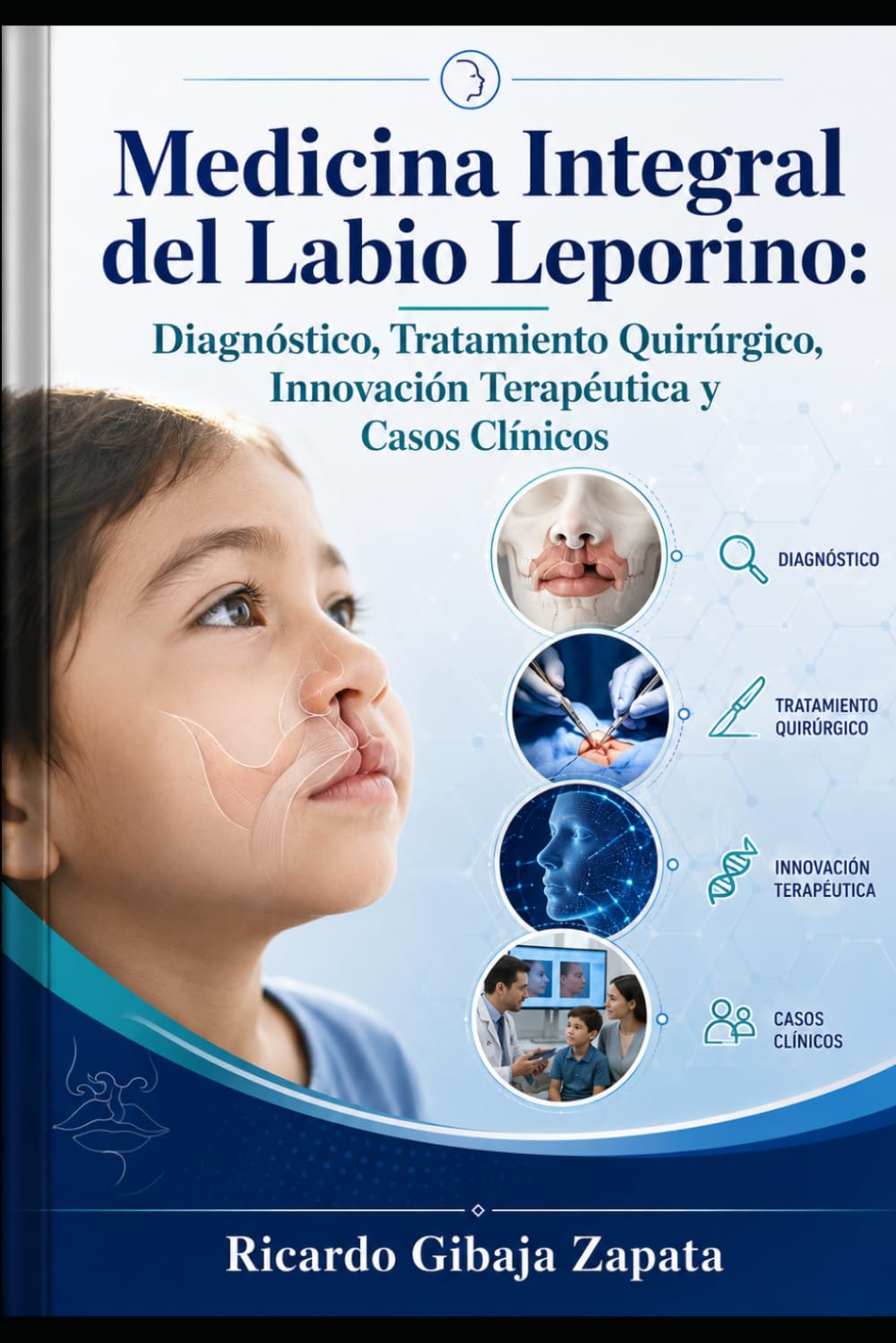 Medicina Integral del Labio Leporino Diagnóstico, Tratamiento Quirúrgico, Innovación Terapéutica y Casos Clínicos