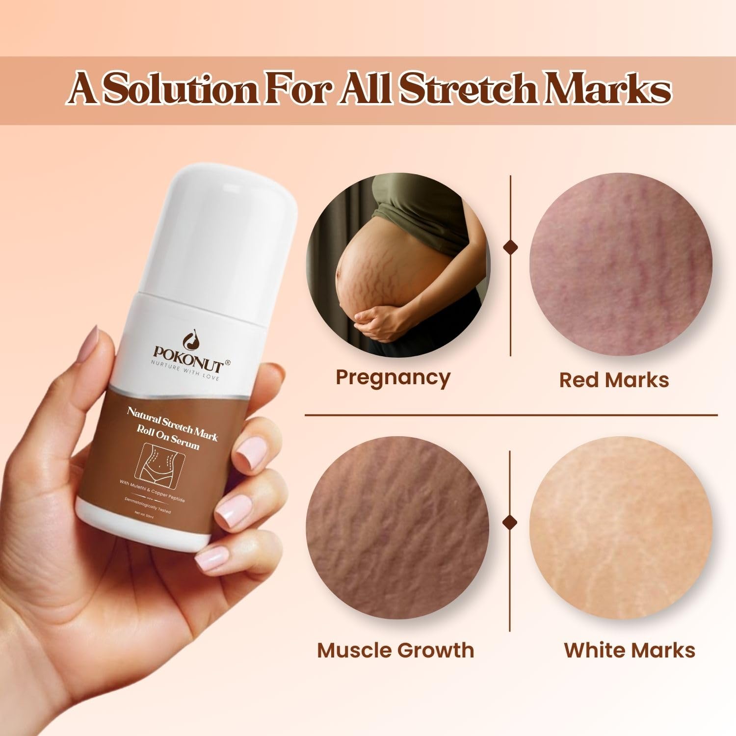 POKONUT Stretch Marks Roll-On Serum for Pregnancy & After Delivery | Mulethi, Hyaluronic Acid & Rosehip Oil | Fades New & Old Stretch Marks & Scars | Dermatologically Tested | For Women & Men | 50ml 3