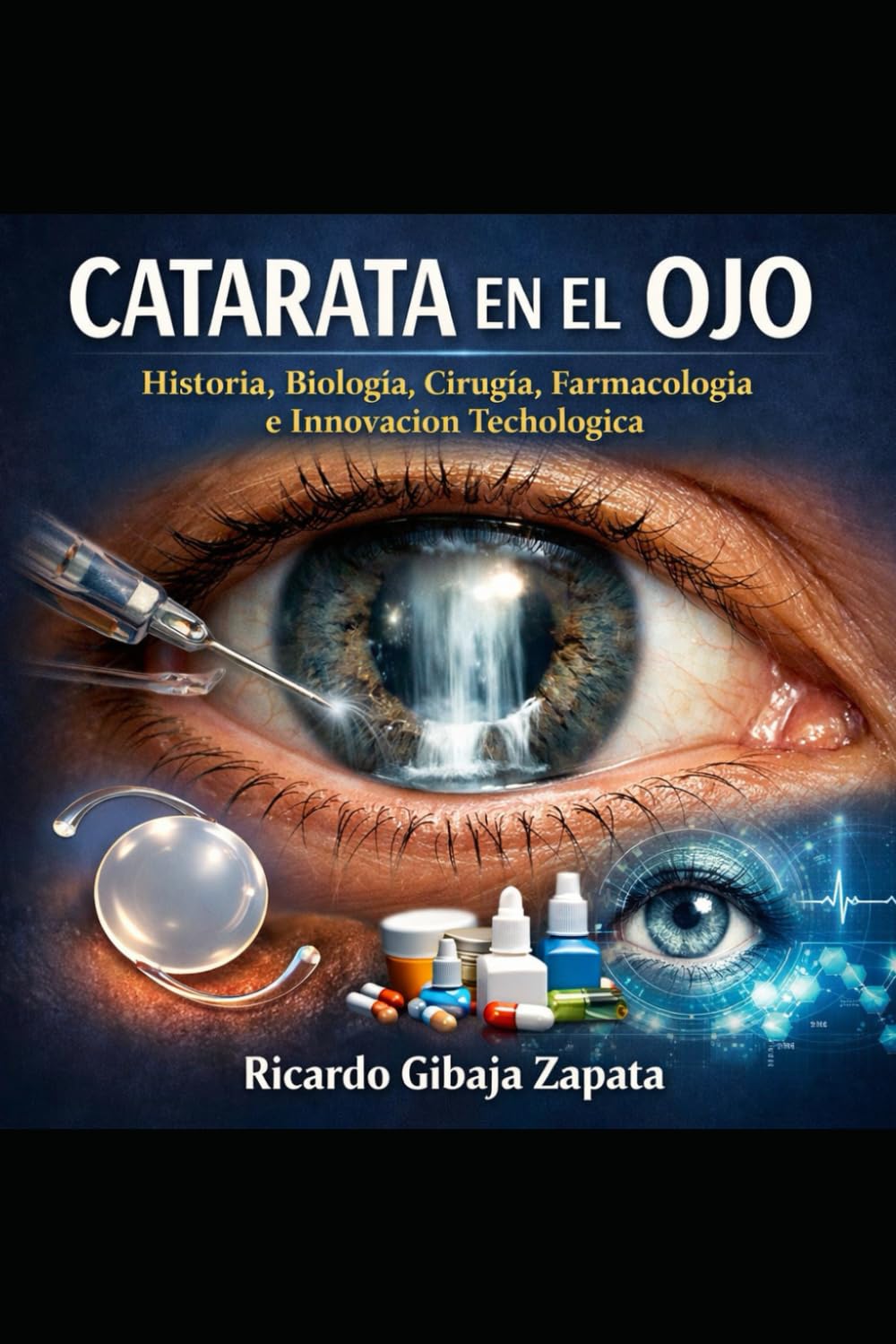 CATARATA EN EL OJO: Historia, Biología, Cirugía, Farmacología e Innovación Tecnológica