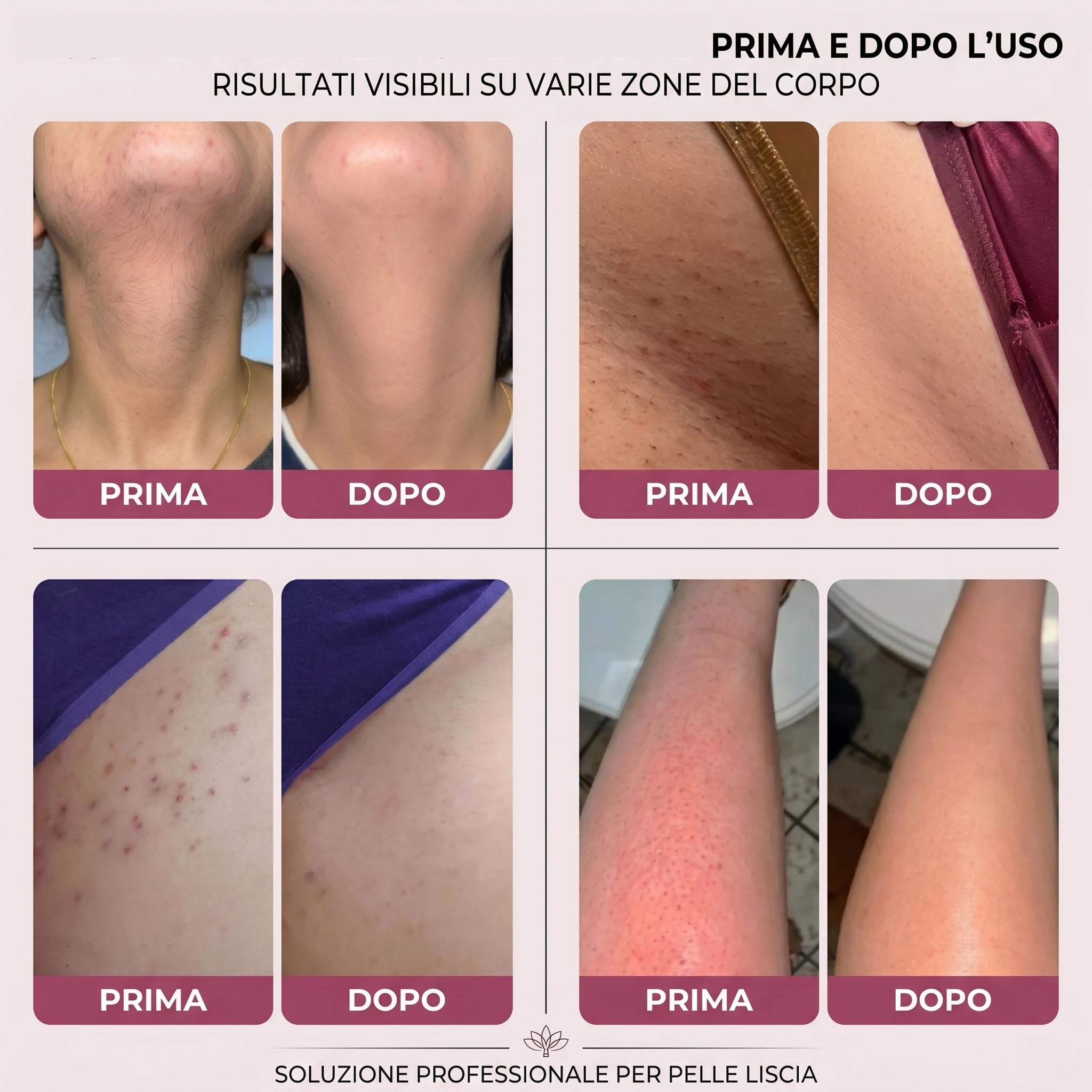 sovalya rasoio Rifinitore Intimo 2 in 1 Donna IPX10 con Lame Ceramica | 2 testine, IPX7, uso wet dry, zona bikini, viso e corpo, ricarica rapida, lame in ceramica, design compatto