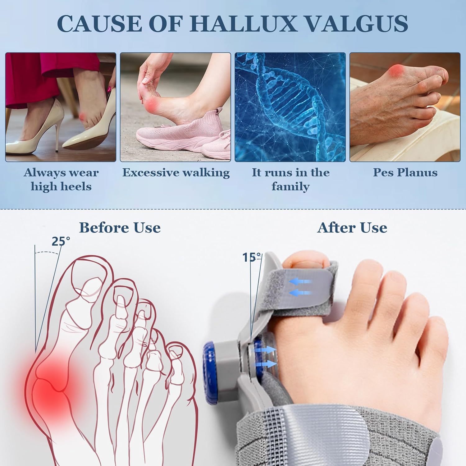 2PCS Bunion Corrector for Women & Men,Adjustable Bunion Fix,Comfortable Toe Straightener-Orthopedic Bunion Splint for Big Toe Alignment,Hallux Valgus Correction,Left/Right Feet Relief(Day & Night)​​