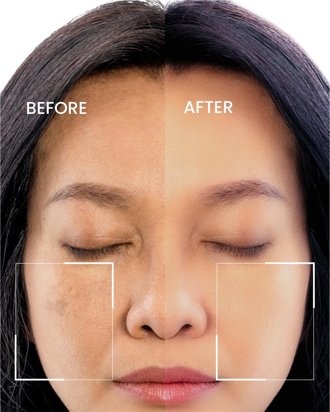 Radiance & Renewal Serum with Hyaluronic Acid, Vitamin C & Kojic Acid – Hydrating Anti-Aging Formula for Smooth, Even-Looking Skin Tone & Texture – 30ml - Image 3