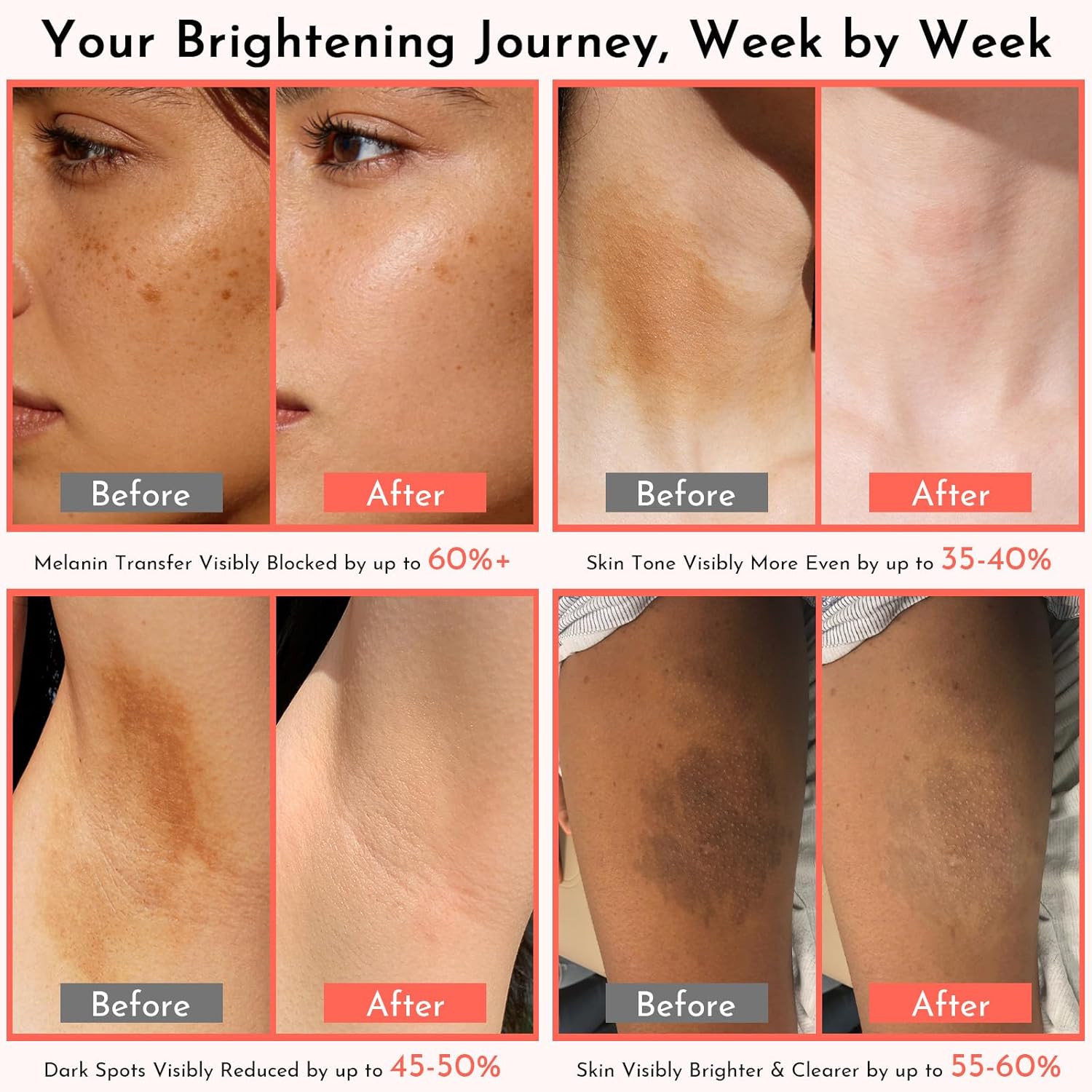Skin Bleaching Cream with Alpha Arbutin - Dark Spot Corrector for Intimate Areas, Underarms & Knees - Niacinamide + Vitamin C Brightening Cream for Elbows, Inner Thighs,100ml for All Skin Types