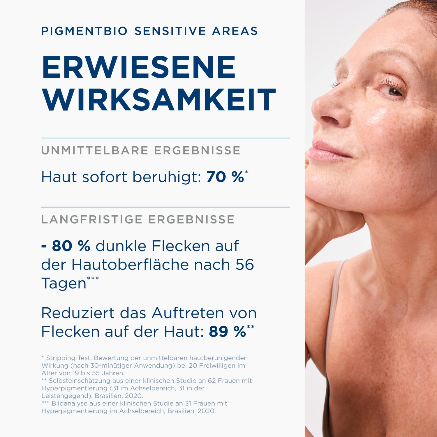 BIODERMA Pigmentbio Sensitive Areas - aufhellende Pflege für empfindliche Stellen - ideal für Knie, Ellenbogen, Achseln, Oberschenkel und Leistengegend - spendet Feuchtigkeit und beruhigt - Tube 75 ml