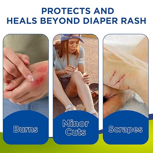 Miniatura 4 de Nivagen Ungüento de óxido de zinc USP 20  Para dermatitis del pañal piel agrietada protege de la humedad alivio de la hiedra venenosa roble venenoso