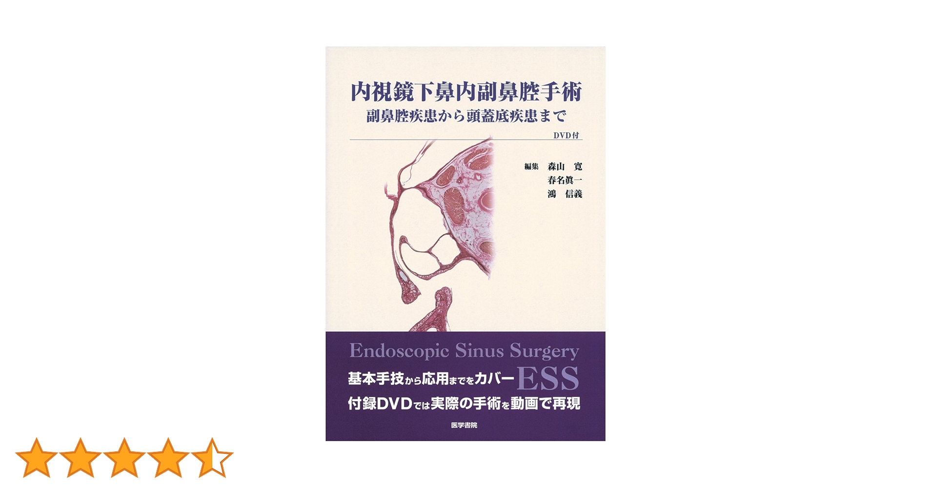 内視鏡下鼻内副鼻腔手術[DVD付] 副鼻腔疾患から頭蓋底疾患まで　森山 寛 Amazon.co.jp: 内視鏡下鼻内副鼻腔手術 [DVD付]: 副鼻腔疾患から