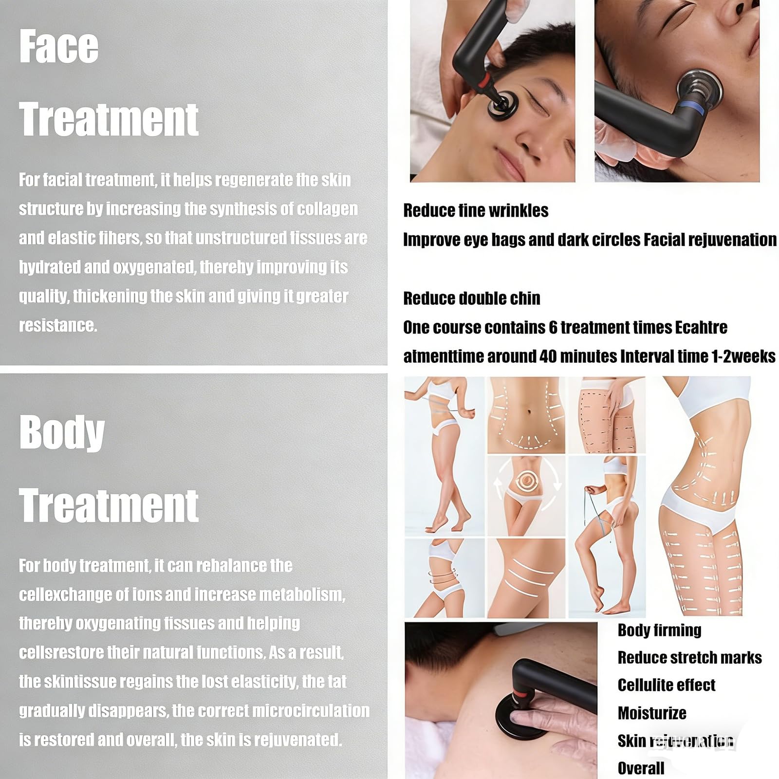 Macchina Gestione Dolore con Diatermia Fisioterapica Tecar Ret 448 Khz Cet, Macchina Tecar Intelligente per Fisioterapia, Sollievo dal Dolore Corporeo, Dimagrimento Corporeo/Lifting Viso