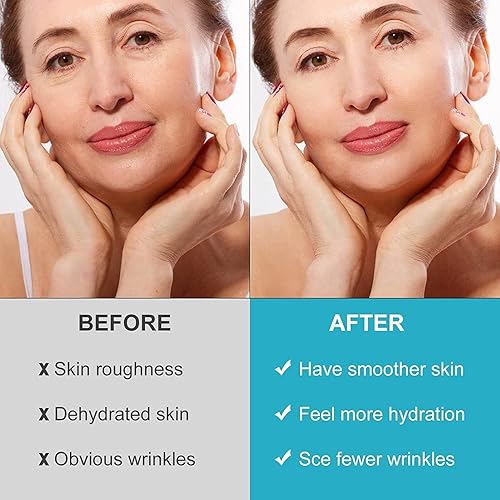 Miniatura 6 de Parches antiarrugas para la frente y la cara, 256 almohadillas para el cuidado de la piel para suavizar las líneas fruncidas, máscara facial de