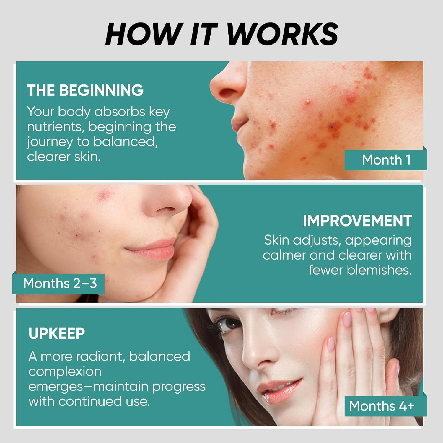 Clear Skin Supplement & Acne Supplement with Vitamin A, DIM, Milk Thistle – Hormonal Balance, Liver Detox & Antioxidant Support – Glutathione, Turmeric, Dandelion – Natural Skin Formula 90 Capsules - Image 6