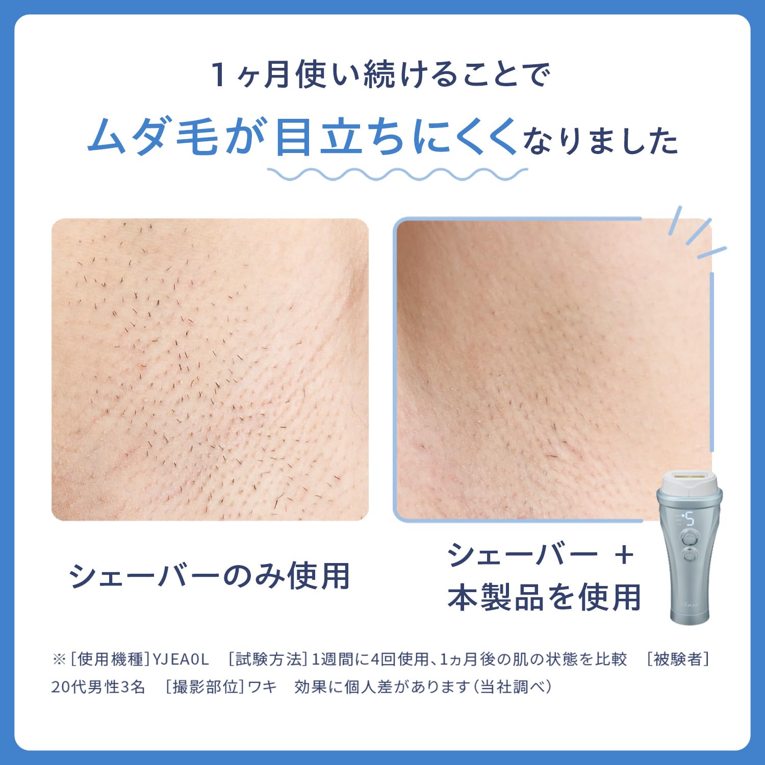 Amazon | ヤーマン 脱毛器カテゴリー 光美容器 レイボーテヴィーナス 