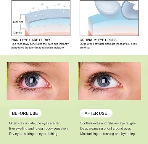 Miniatura 9 de Dioche Humidificador y vaporizador portátil para ojos secos, pulverizador de niebla para hidratar, vapor rápido, maquillaje (azul)