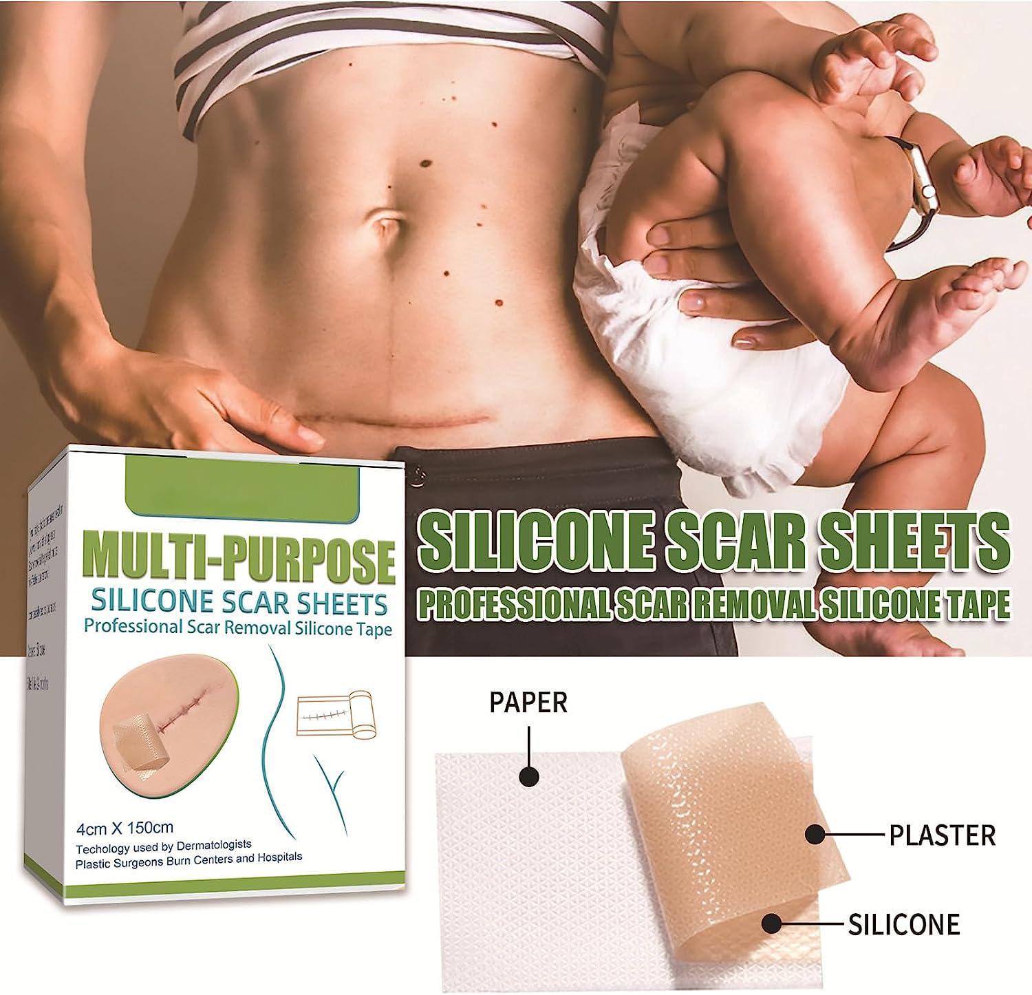 Cerotti Silicone Cicatrici, Cerotto a Nastro, Crema Cicatrici Chirurgiche, Fogli per Cicatrici in Silicone per Acne, Cheloidi, Ustioni, Smagliature, Cicatrici Da Taglio Cesareo (4X 150 cm