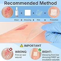 Vista 5 de ClearShield Apósito de Película Transparente 4" x 4.75" Paquete de 50, Vendajes Impermeables Transpirables Hipoalergénicos, Parche Adhesivo
