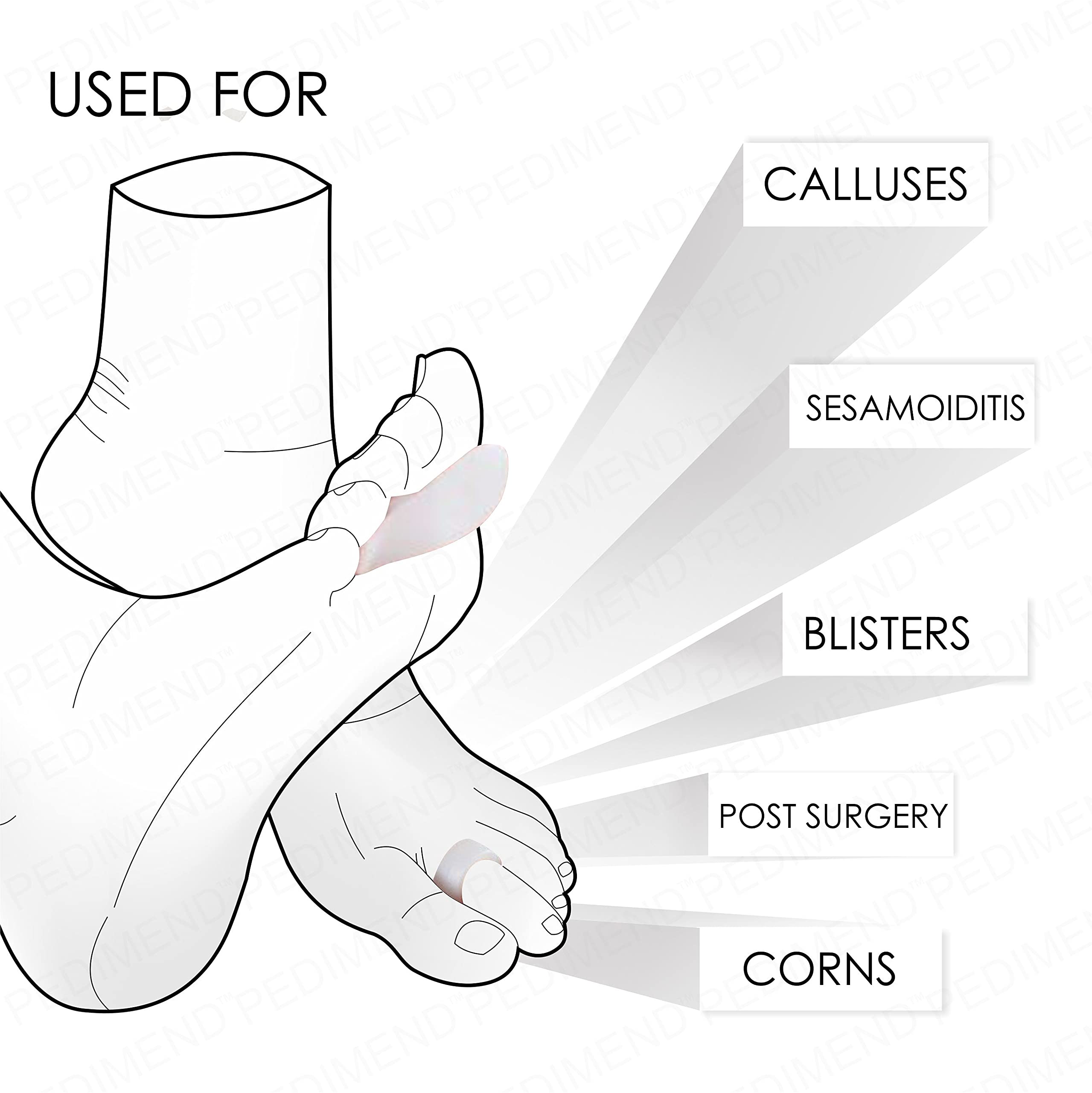 Supporto Dita A Martello Oppo Misura Large. Previene Callosita' E Dita - Foto 3