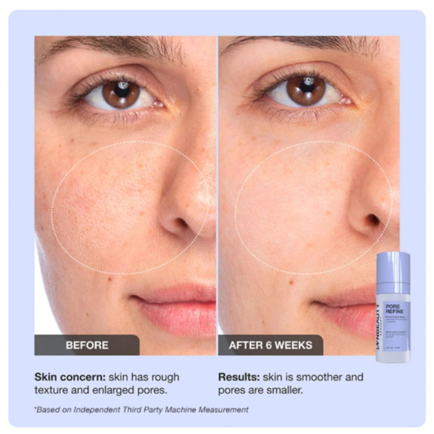 INNBEAUTY Project Pore Refine Serum for Shrinking Pores & Texture Smoothing, 1 OZ (30ml)