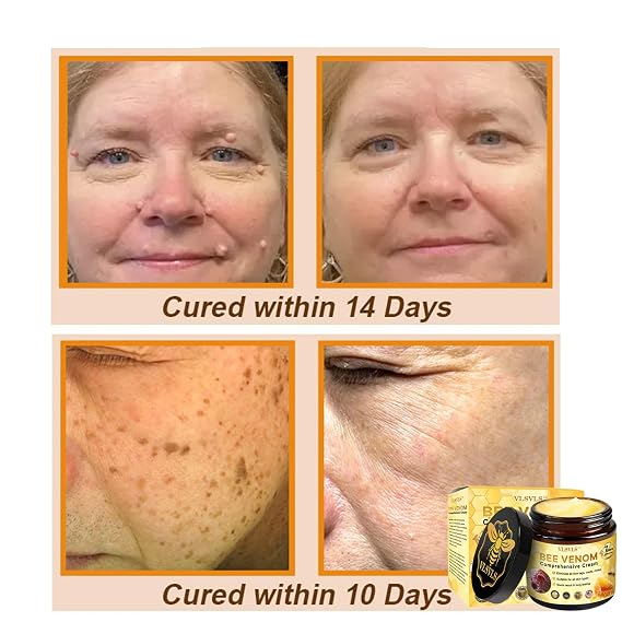 Bee Venom Comprehensive Cream, Professional Bee Venom Skin Treatment Cream, Bee Venom Skin Restoration Cream-50g, Repair, Moisturize and lift 3 in 1, for All skin Types (1 Pack)