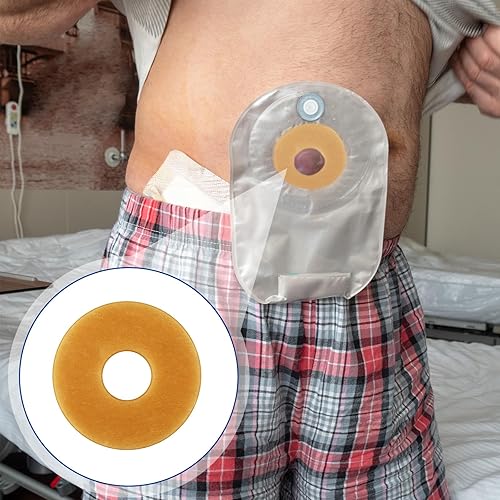 Miniatura 6 de Los anillos de barrera para ostomía se adaptan al extensor de piel moldeable, diámetro exterior de 2 pulgadas (1.890 in) a 0.079 in de grosor, bolsa