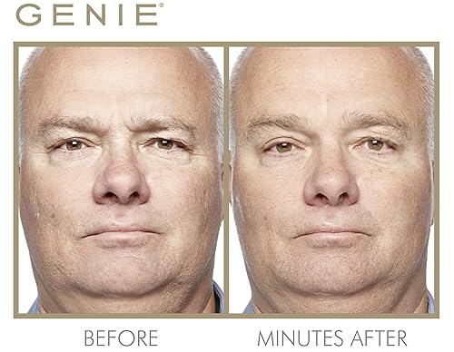 Miniatura 8 de Corrector de líneas de expresión instantáneo