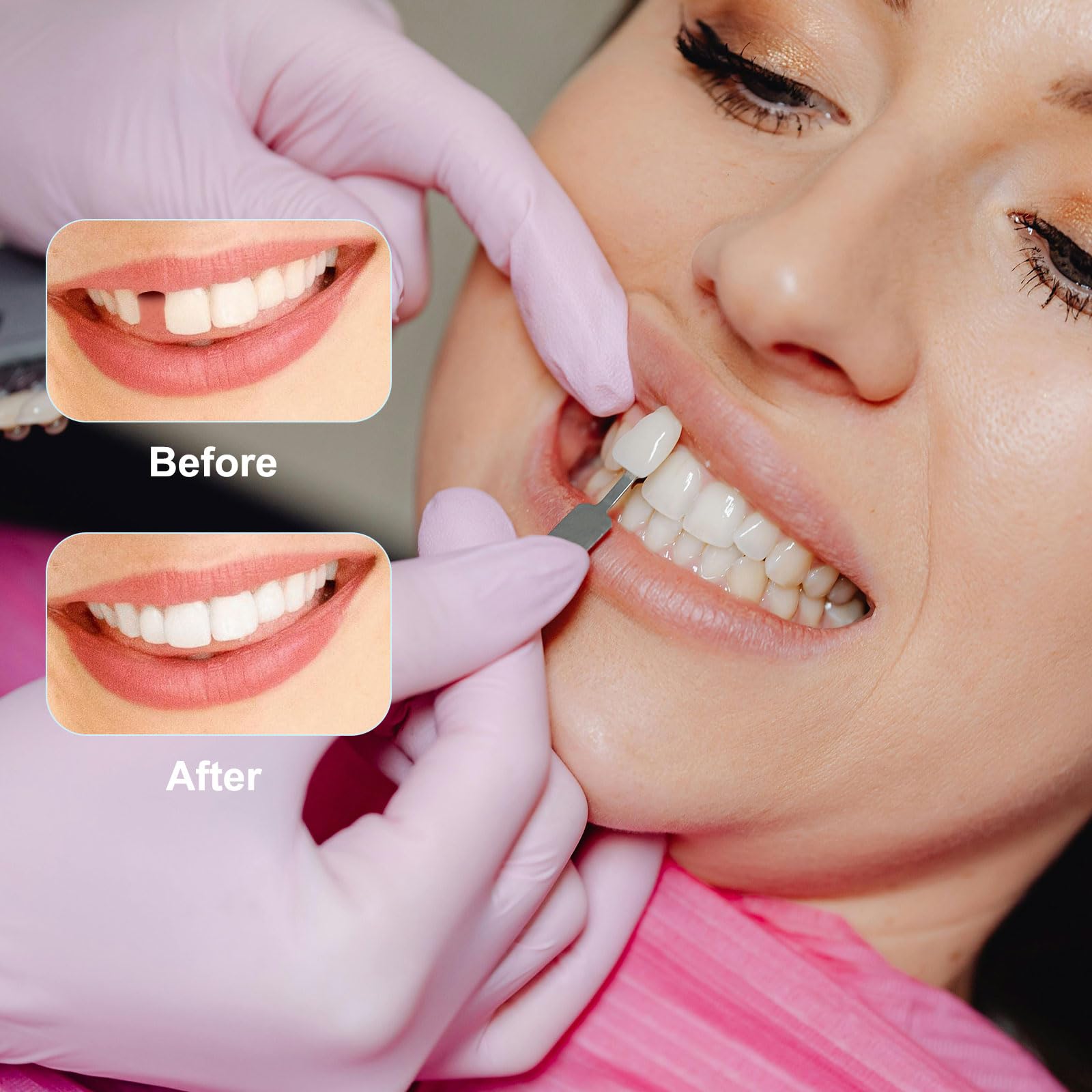 SKHAOVS 7 Pares Dentaduras Postizas Instantáneas Dientes de Carillas Cosméticas, Dentaduras Temporales Postizos de Superior E Inferior Dientes, Perfecta Sonrisa Dientes Prótesis Chapa