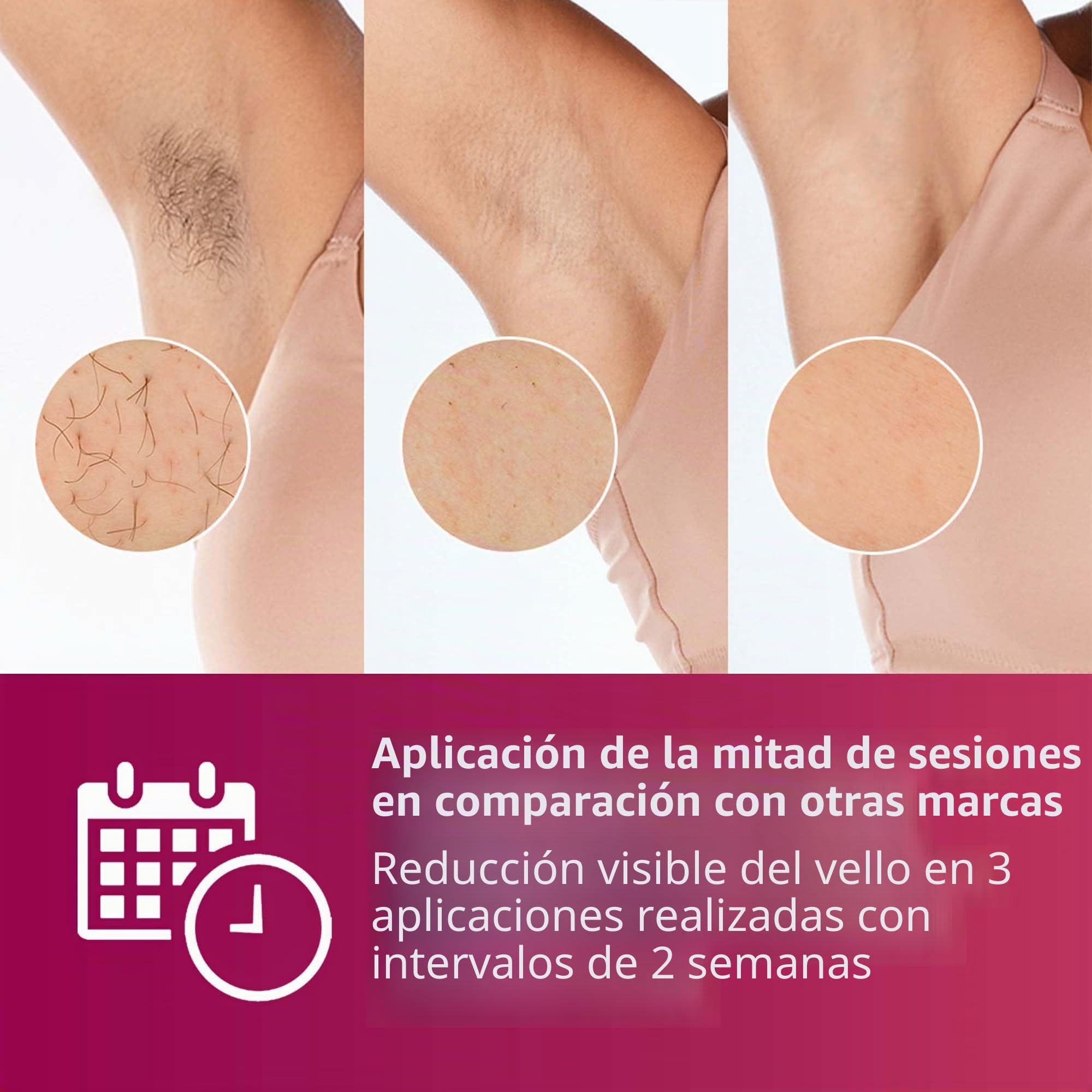 Philips Lumea Advanced Dispositivo de depilación IPL SC1997/00 - Depilación con luz (Oro, Blanco, Luz pulsada doméstica (HPL), 15 min, 1 min, 1 min, 1 min)
