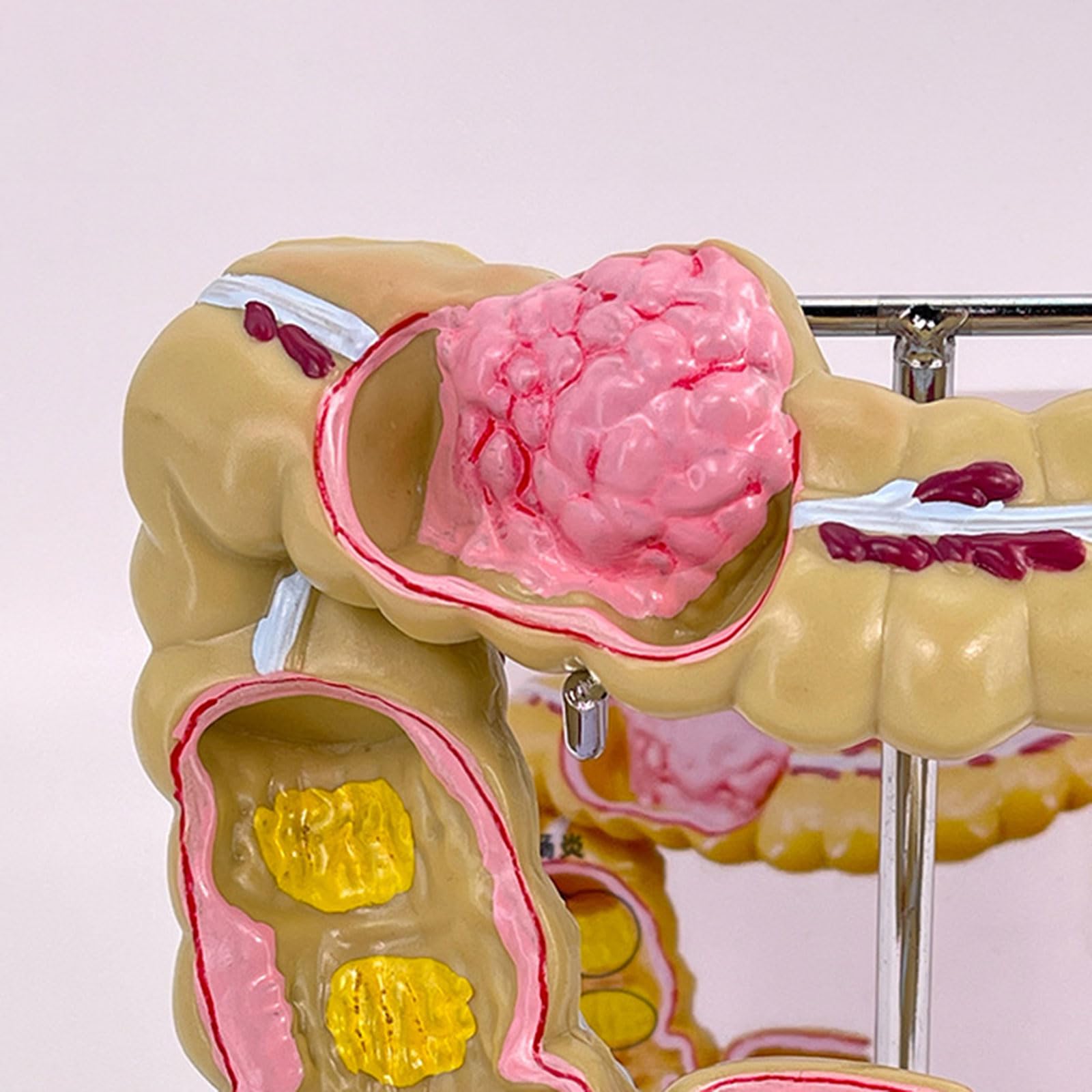 Modello umano dell'intestino crasso Patologie umane del modello dell'intestino crasso Strumento didattico per studi scolastici di laboratorio Patologie del modello dell'intestino crasso Modello di