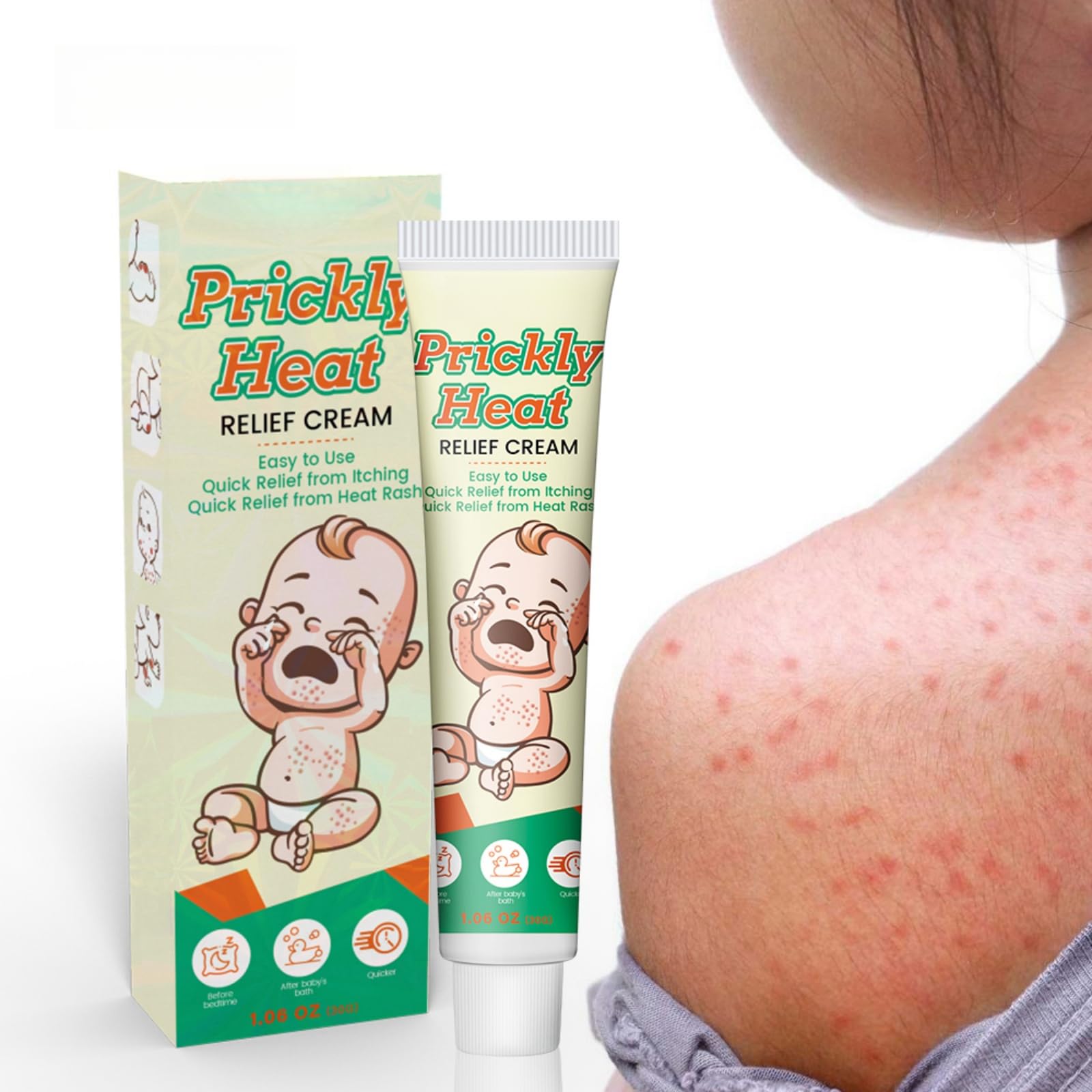 POSICHE Prickly Heat Relief Cream 30g Herbal Formula for Quick Itch Relief, Effective Treatment for Heat Rash & Red Itching, Fast Relief in Hot & Humid Environments, Alleviates Sweat Duct Obstruction