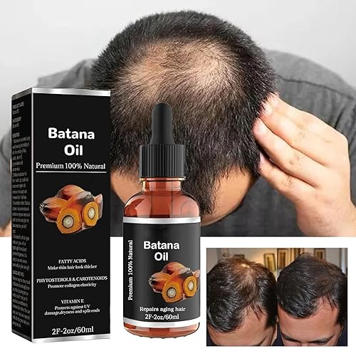 Miniatura 7 de Aceite de batana orgánico de Batana para cabello saludable, aceite de tratamiento capilar Batana, 100% natural, mejora el brillo del cabello y la